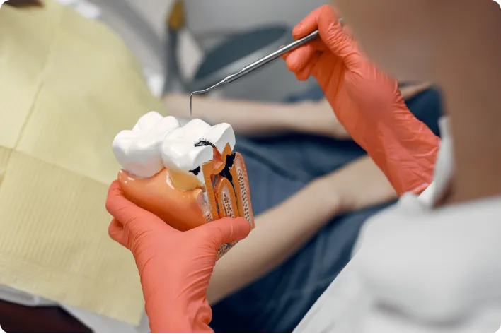 Crowns, Root Canal Treatment, and Restorations