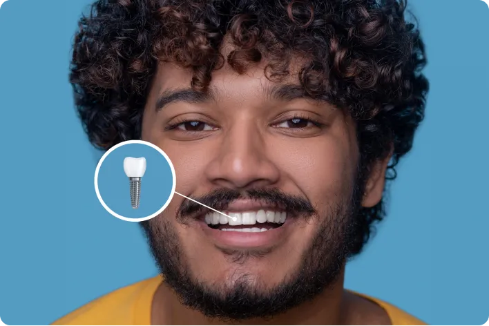 Single Tooth Implant Replacement